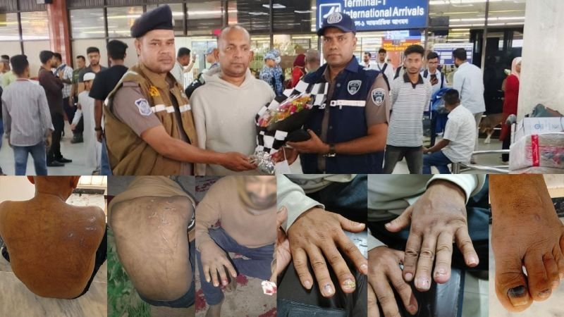 ইতালির স্বপ্ন দেখিয়ে লিবিয়ায় বিক্রি, নির্যাতনে আদায় ৬৩ লাখ টাকা