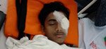 হবিগঞ্জে হামলায় আহত: বাঁ চোখে অস্ত্রোপচার, ডান চোখের দৃষ্টিও ঝাপসা