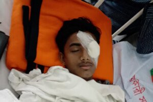 হবিগঞ্জে হামলায় আহত: বাঁ চোখে অস্ত্রোপচার, ডান চোখের দৃষ্টিও ঝাপসা